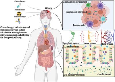 Current understanding of the human microbiome in glioma